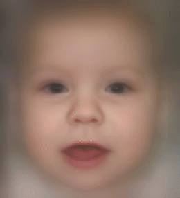 Beckwith-Wiedemann Syndrome