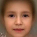 common features of marfan syndrome