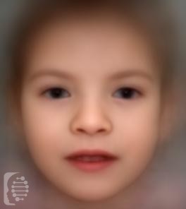 Cri-Du-Chat Syndrome OMIM #123450