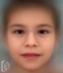 Congenital Disorder of Glycosylation, Type Ia