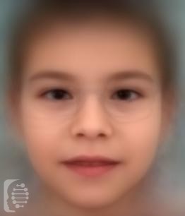 Congenital Disorder of Glycosylation, Type Ia