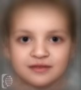 Blepharocheilodontic Syndrome