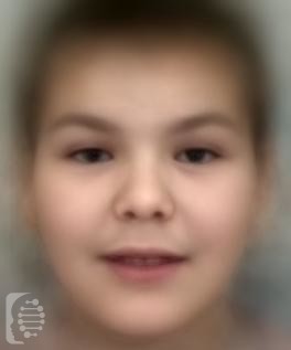 Borjeson-Forssman-Lehmann Syndrome