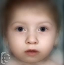 Catel-Manzke Syndrome
