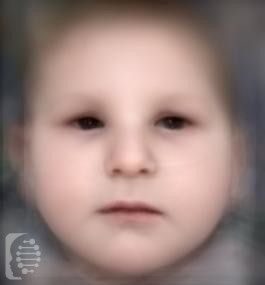 Cerebrooculofacioskeletal Syndrome