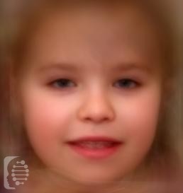 Desanto-Shinawi syndrome OMIM #616708