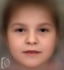 Chromosome 2q37 Deletion syndrome