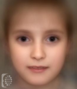 ehlers danlos syndrome