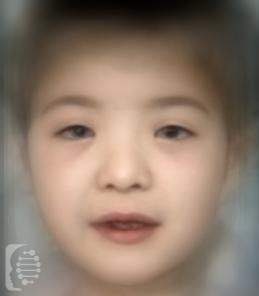 Hennekam Lymphangiectasia-Lymphedema Syndrome 1