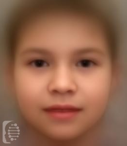 Klinefelter syndrome