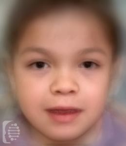 Alpha-mannosidosis syndrome